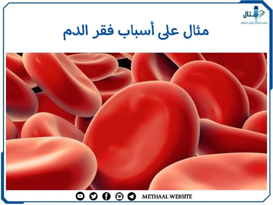 مثال على أسباب فقر الدم مثال على أسباب فقر الدم