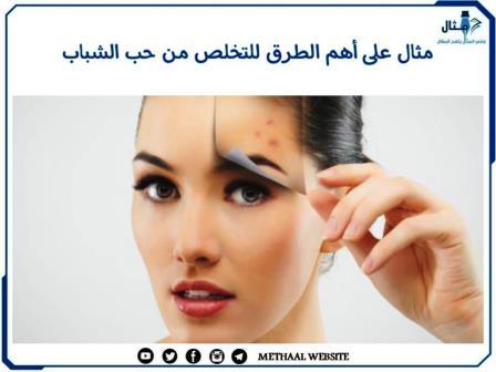 مثال على أهم الطرق للتخلص من حب الشباب مثال على أهم الطرق للتخلص من حب الشباب