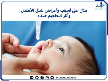 مثال على أسباب وأعراض شلل الأطفال وآثار التطعيم ضده