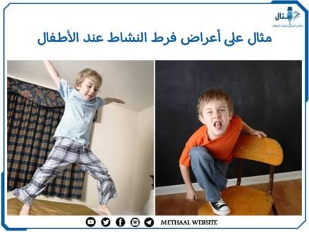 مثال على أعراض فرط النشاط عند الأطفال