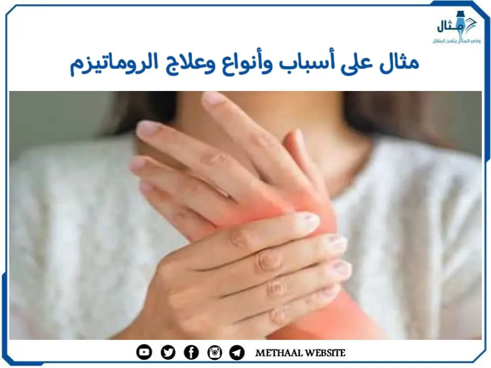 مثال على أسباب وأنواع وعلاج الروماتيزم