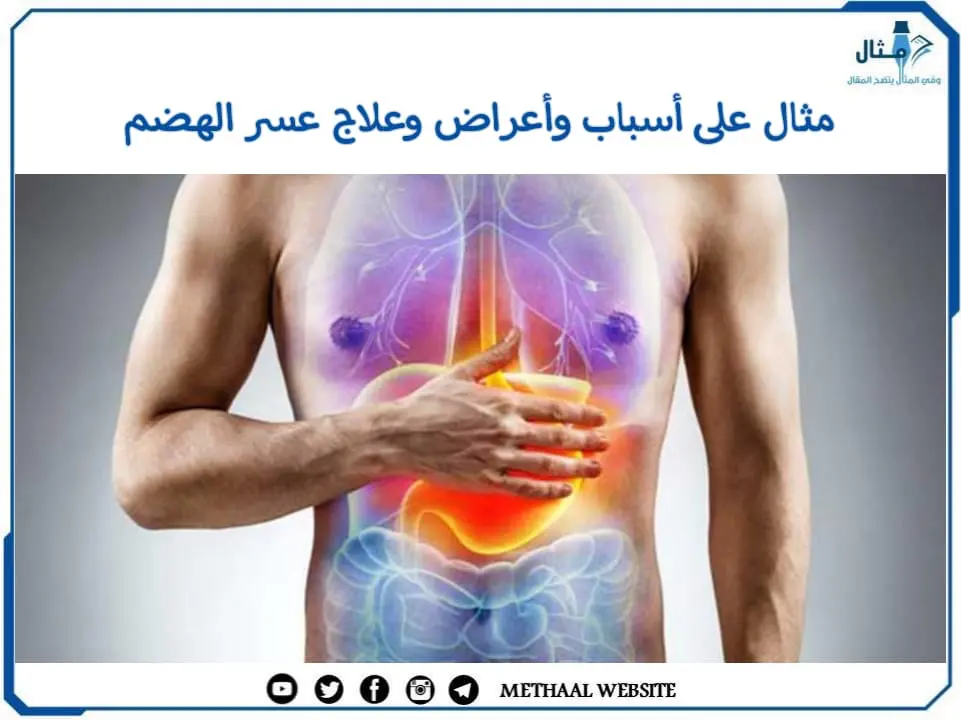 مثال على أسباب وأعراض وعلاج عسر الهضم مثال على أسباب وأعراض وعلاج عسر الهضم