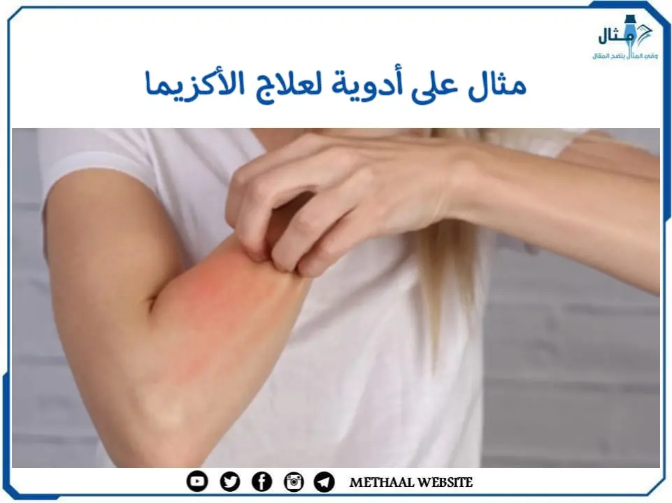 مثال على أدوية لعلاج الأكزيما مثال على أدوية لعلاج الأكزيما