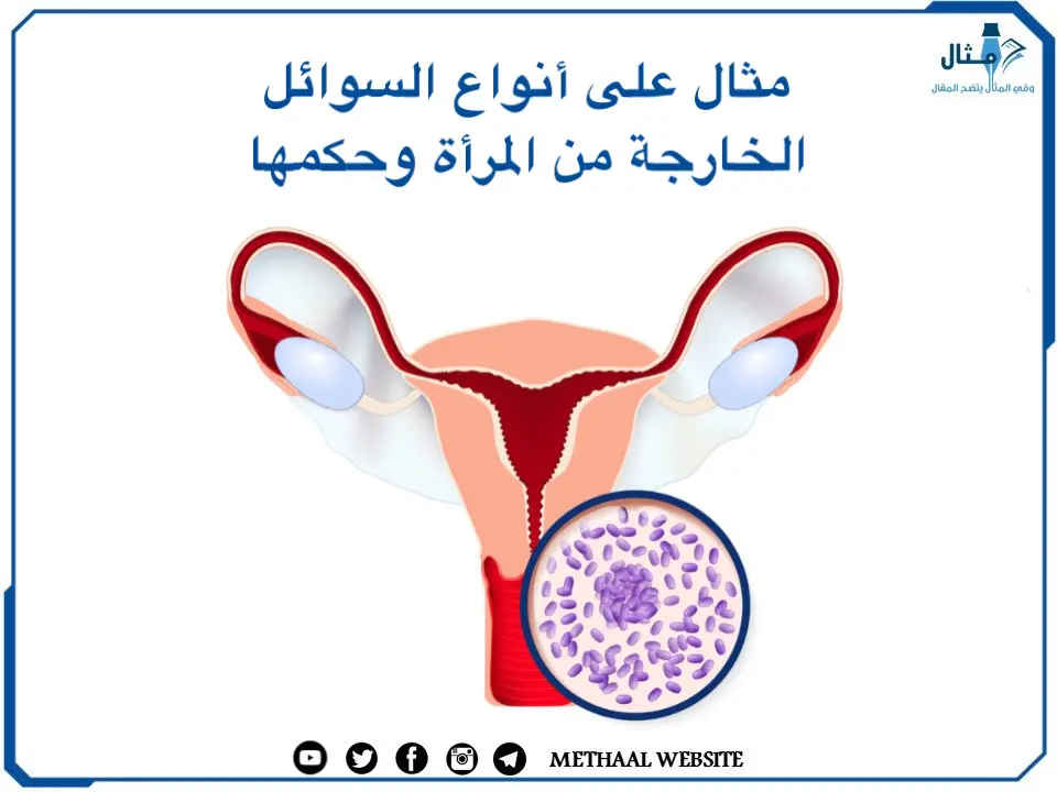 مثال على أنواع السوائل الخارجة من المرأة وحكمها مثال على أنواع السوائل الخارجة من المرأة وحكمها