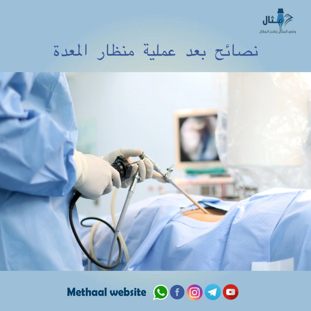 نصائح بعد عملية منظار المعدة نصائح بعد عملية منظار المعدة