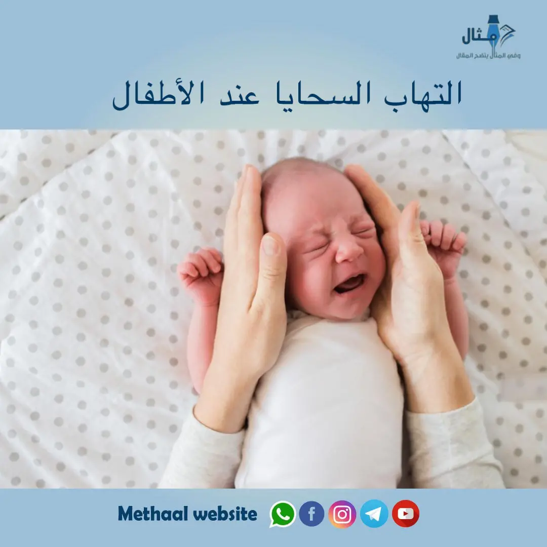 التهاب السحايا عند الأطفال التهاب السحايا عند الأطفال