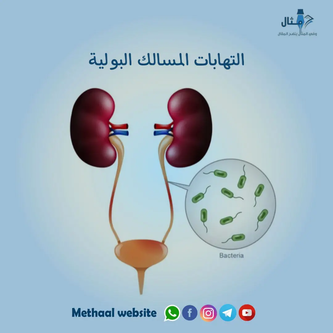 التهابات المسالك البولية