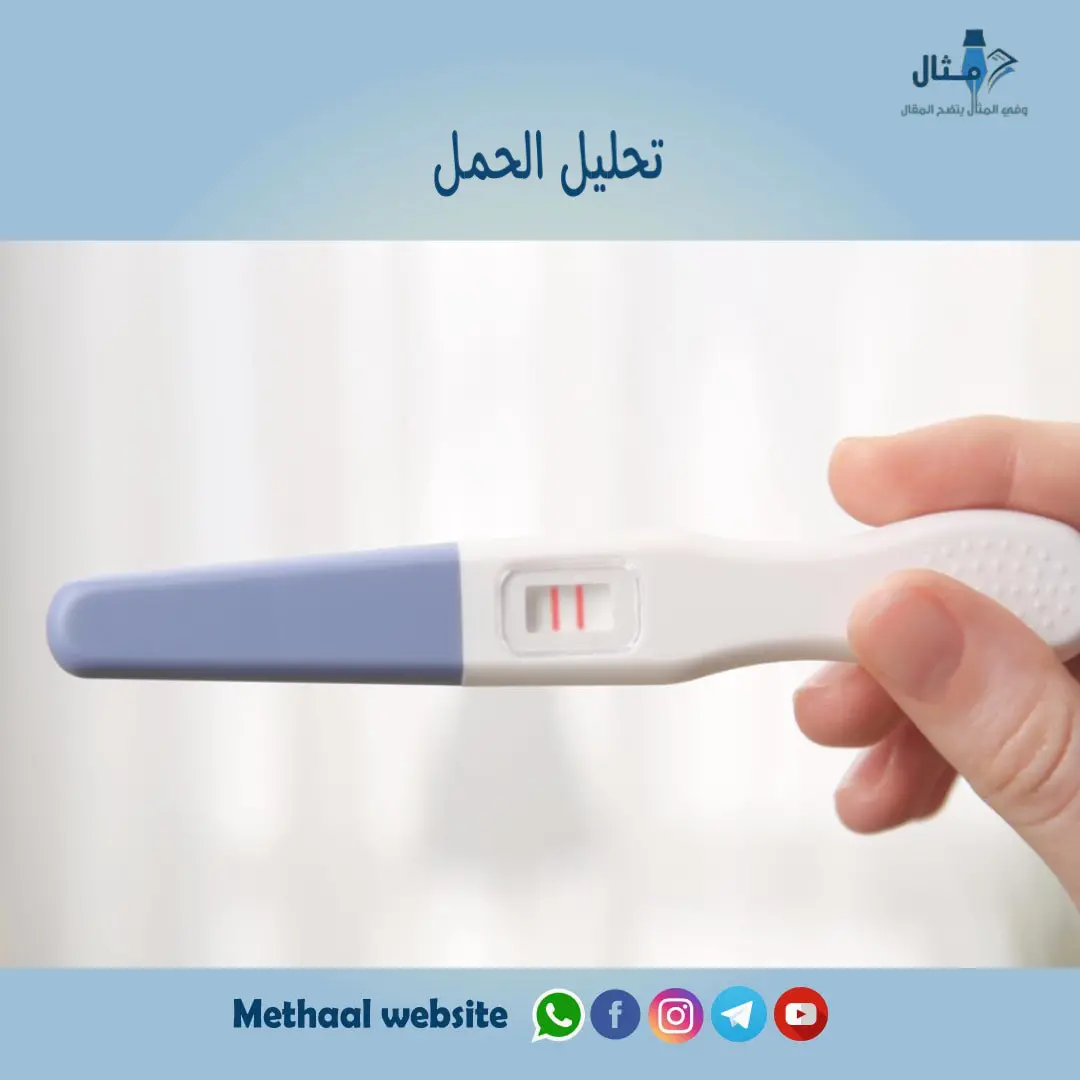 تحليل الحمل تحليل الحمل