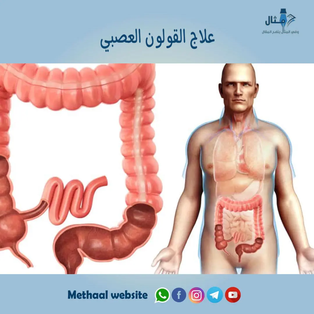 علاج القولون العصبي علاج القولون العصبي