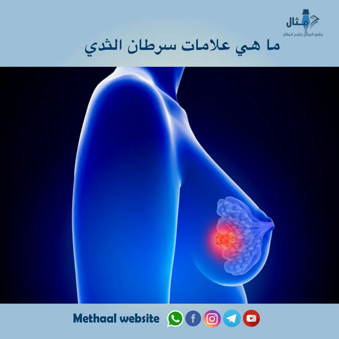 ما هي علامات سرطان الثدي ما هي علامات سرطان الثدي