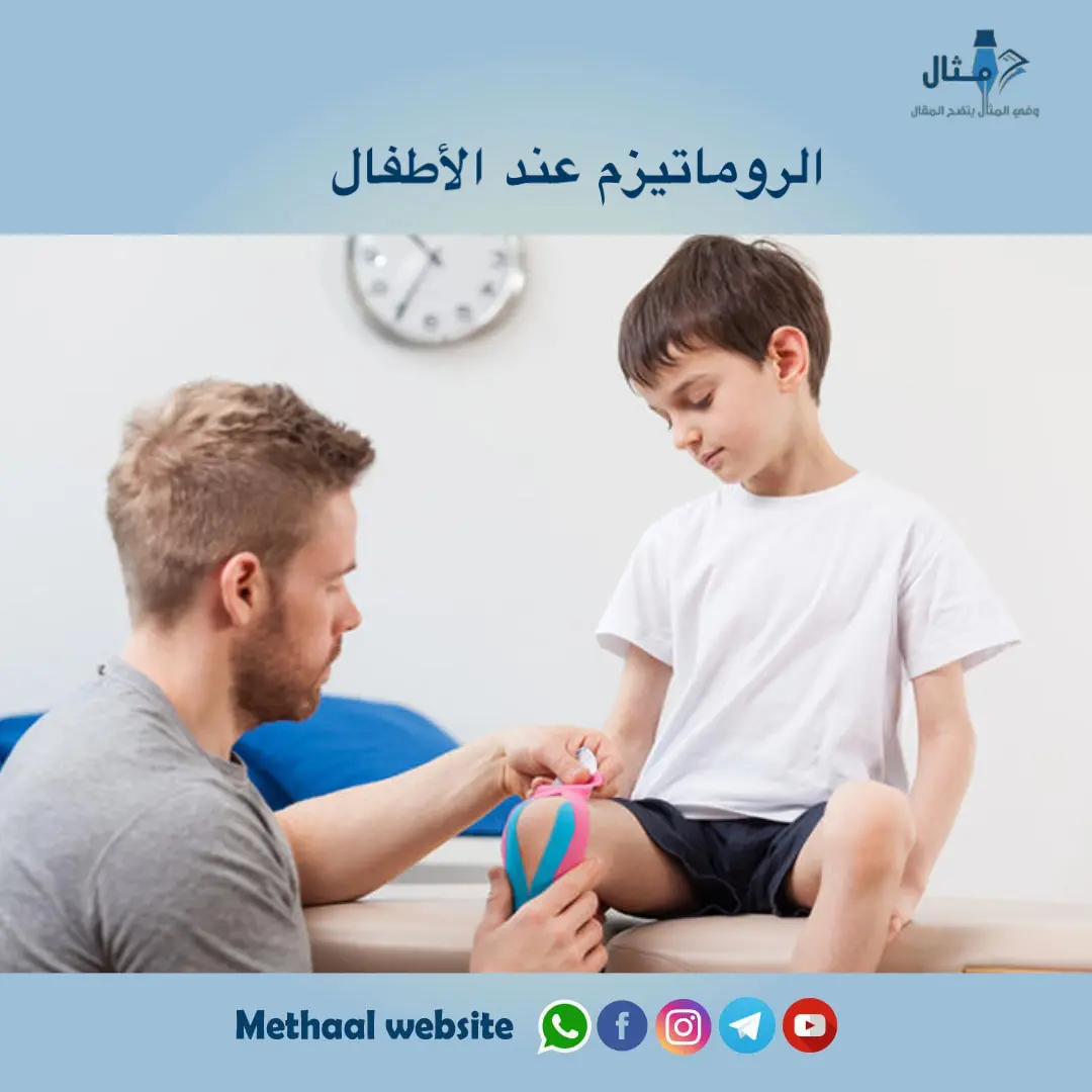 الروماتيزم عند الاطفال الروماتيزم عند الاطفال