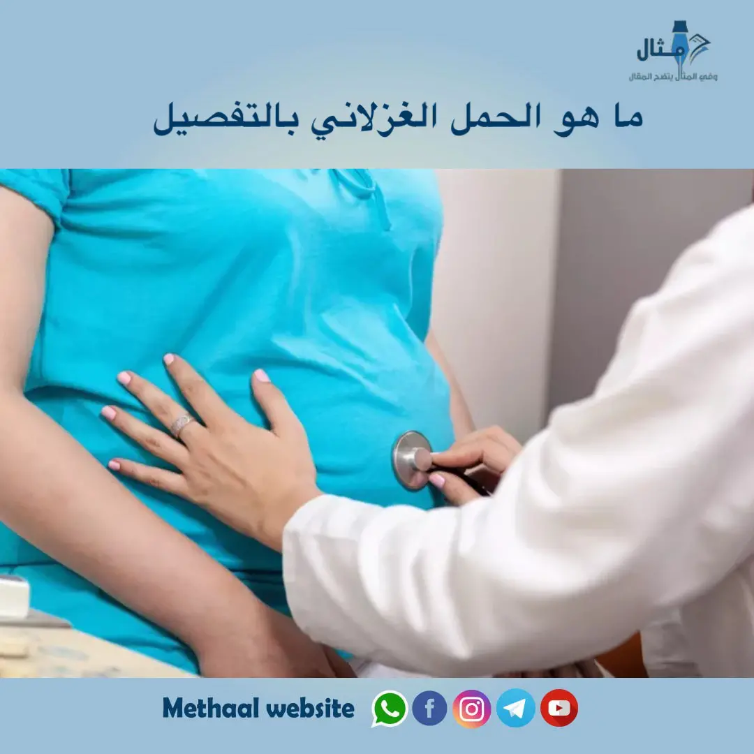 ما هو الحمل الغزلاني بالتفصيل ما هو الحمل الغزلاني بالتفصيل
