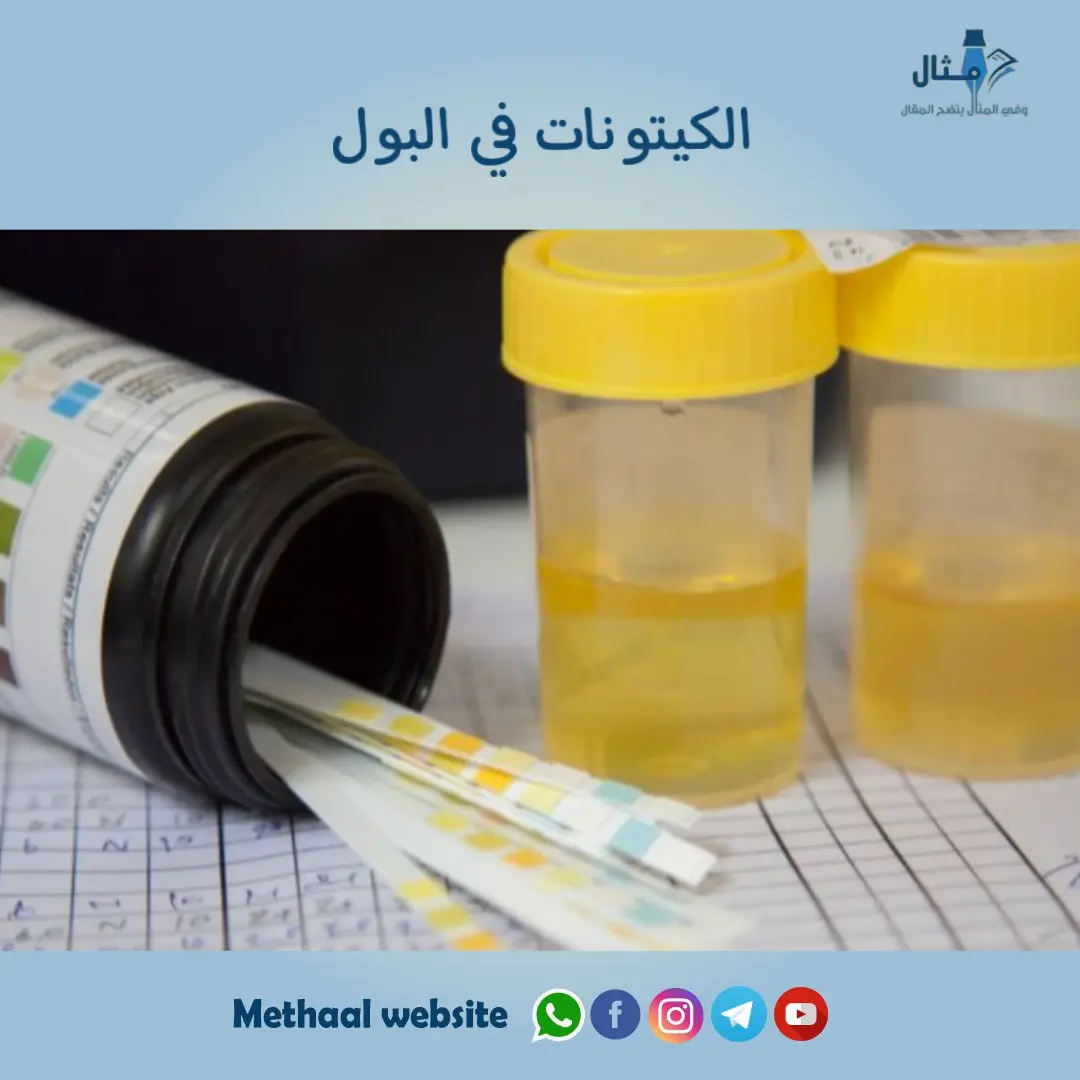 الكيتونات في البول الكيتونات في البول