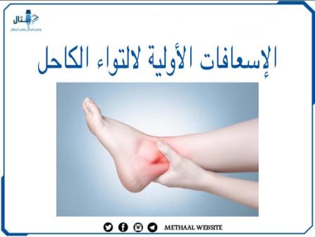 الإسعافات الأولية لالتواء الكاحل الإسعافات الأولية لالتواء الكاحل
