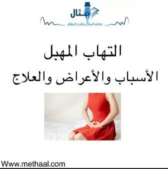 التهاب المهبل الأسباب والأعراض والعلاج