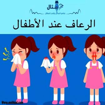 الرعاف عند الأطفال الرعاف عند الأطفال