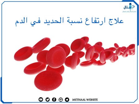 علاج ارتفاع نسبة الحديد في الدم
