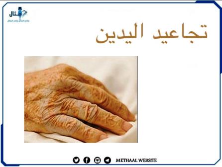 تجاعيد اليدين الأسباب والحلول تجاعيد اليدين الأسباب والحلول