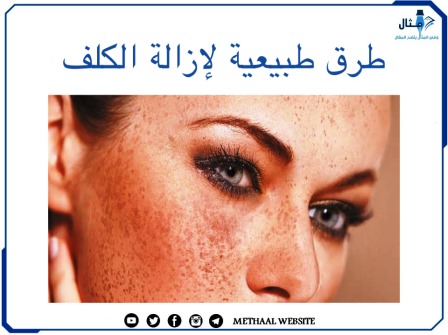 طرق طبيعية لإزالة الكلف