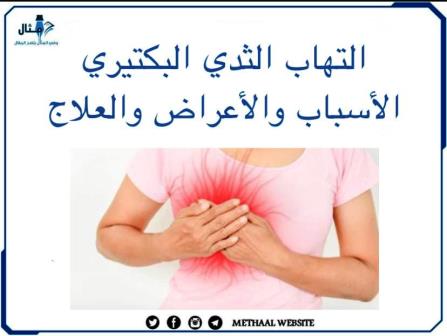 التهاب الثدي البكتيري، الأسباب والأعراض والعلاج التهاب الثدي البكتيري، الأسباب والأعراض والعلاج