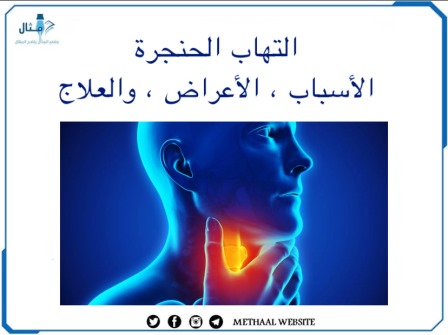 التهاب الحنجرة، الأسباب والأعراض والعلاج