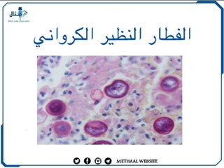 الفطار النظير الكرواني الفطار النظير الكرواني