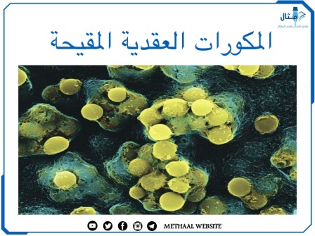 المكورات العقدية المقيحة Streptococcus Pyogenes