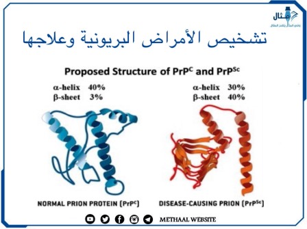 تشخيص الأمراض البريونية و علاجها 