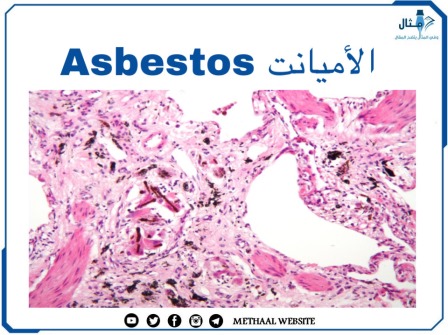 الأميانت Asbestos