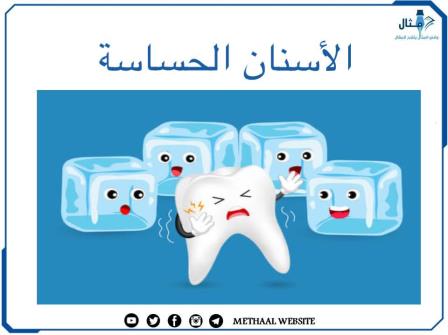 الأسنان الحساسة الأسنان الحساسة