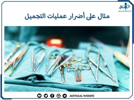 مثال على أضرار عمليات التجميل