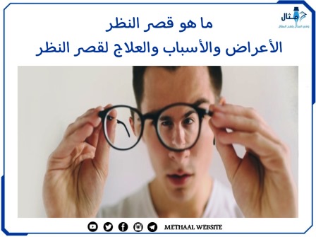 ما هو قصر النظر، الأعراض والأسباب والعلاج لقصر النظر