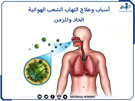 مثال على أسباب وعلاج التهاب الشعب الهوائية الحاد والمزمن