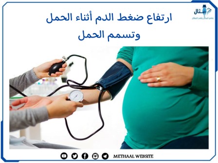 ارتفاع ضغط الدم أثناء الحمل وتسمم الحمل