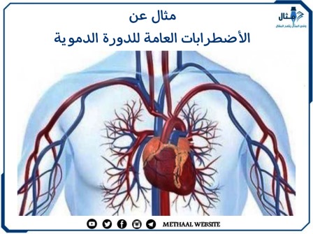 مثال على الأضطرابات العامة للدورة الدموية