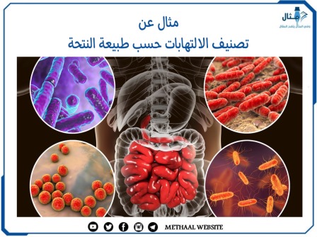 مثال على تصنيف الالتهابات حسب طبيعة النتحة