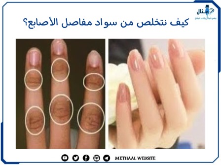 كيف أتخلص من سواد مفاصل الأصابع؟