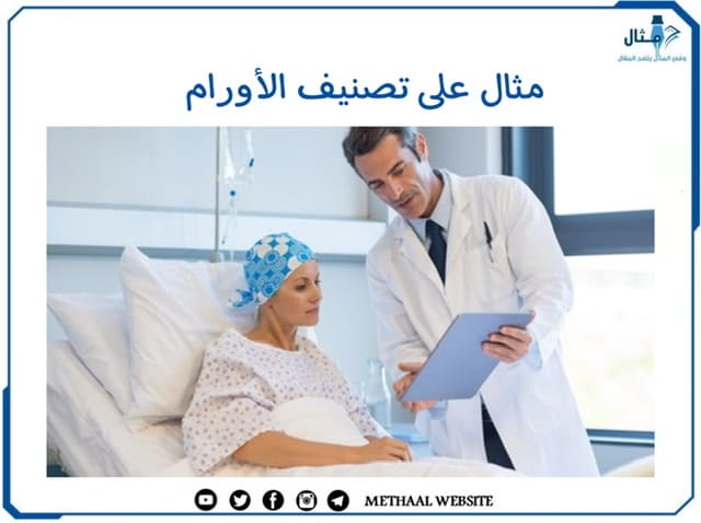 مثال على تصنيف الأورام مثال على تصنيف الأورام