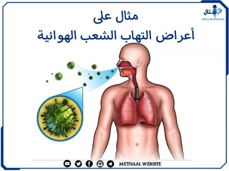 مثال على أعراض التهاب الشعب الهوائية