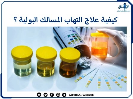 كيفية علاج التهاب المسالك البولية