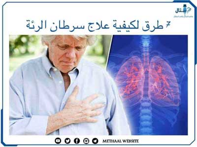 7 طرق لكيفية علاج سرطان الرئة 7 طرق لكيفية علاج سرطان الرئة