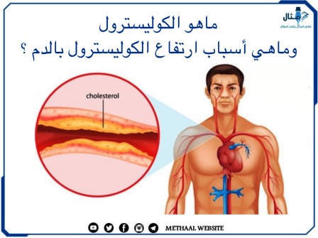 ما هو الكوليسترول وما هي أسباب ارتفاع الكوليسترول في الدم