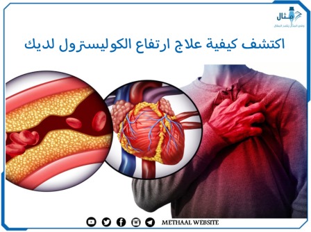 اكتشف كيفية علاج ارتفاع الكوليسترول لديك