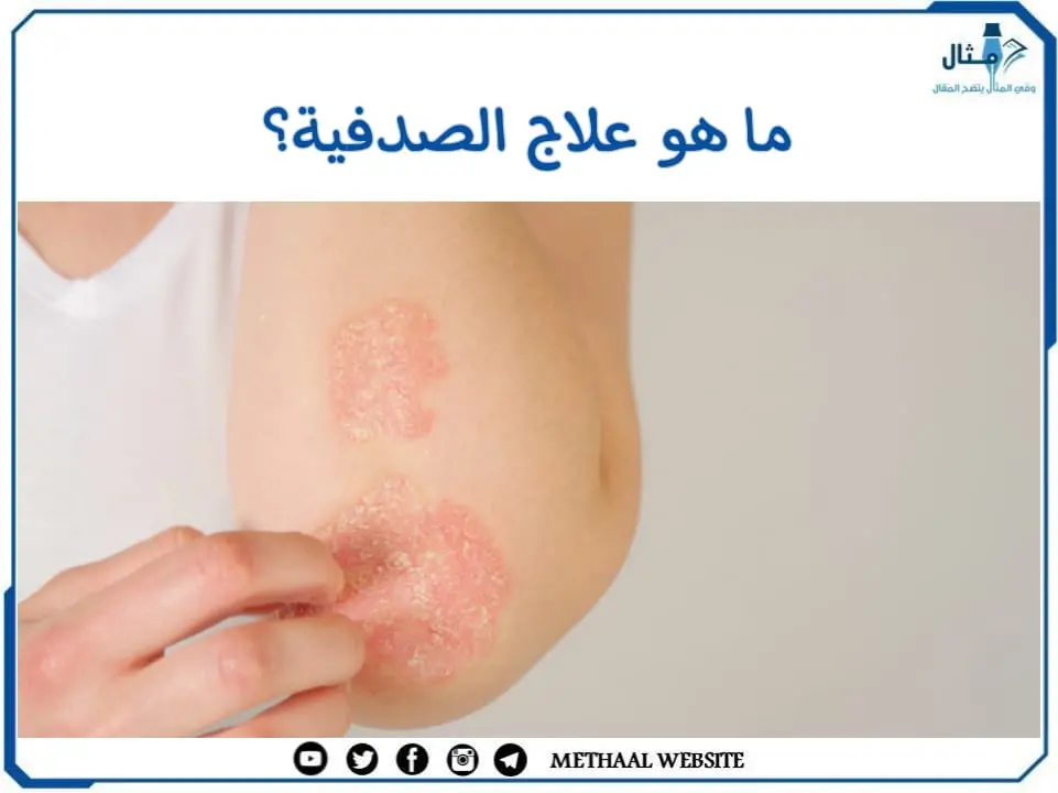ما هو علاج مرض الصدفية؟ ما هو علاج مرض الصدفية؟