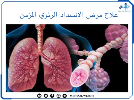 علاج مرض الانسداد الرئوي المزمن