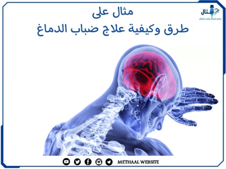 مثال على طرق وكيفية علاج ضباب الدماغ