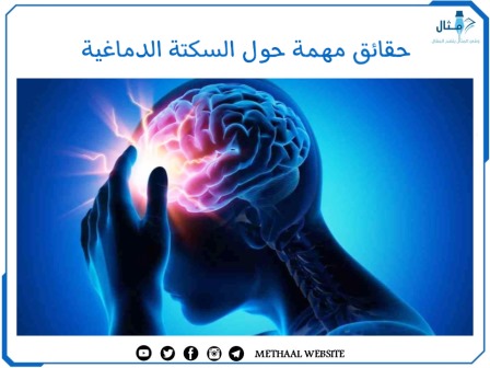 حقائق مهمة حول السكتة الدماغية