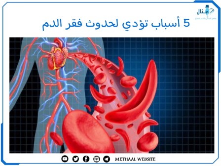 5 أسباب تؤدي لحدوث فقر الدم