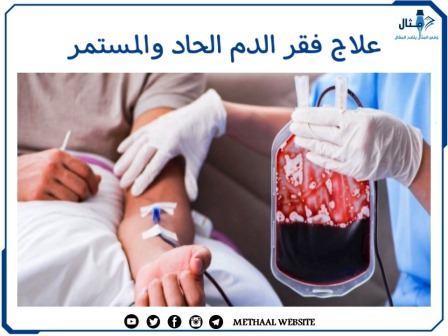علاج فقر الدم الحاد والمستمر