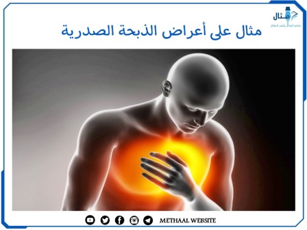 مثال على أعراض الذبحة الصدرية